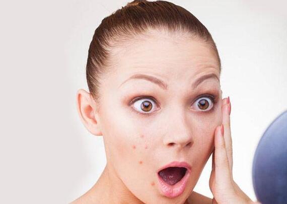 长痘痘怎么不留痘印 这样做才能维持皮肤的光滑！