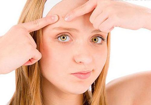 油性肌肤长痘痘怎么办 7个方法拯救你的皮肤