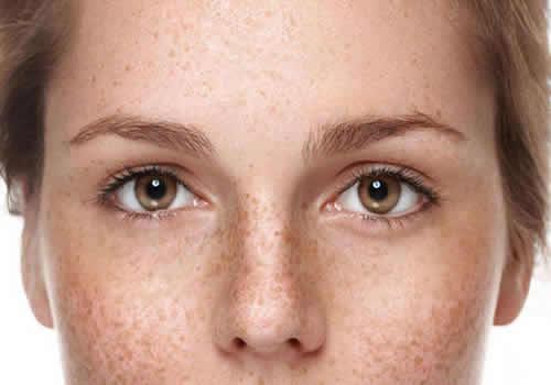 不洗脸脸上会长斑吗 怎样洗脸不容易长斑