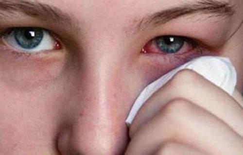 眼睛哭肿了怎么快速消肿 介绍几个给眼睛消肿的方法