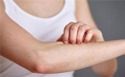 皮肤过敏瘙痒怎么办 五个止痒小妙招教给你