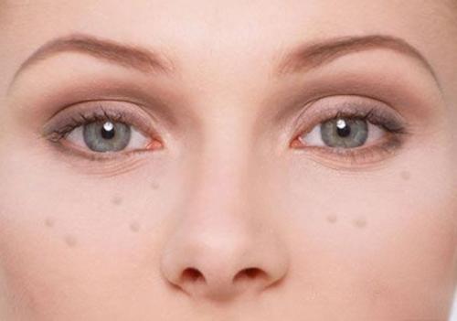 皮肤营养过剩的症状 哪些皮肤不宜使用高营养护肤品