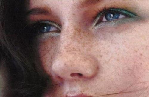 脸上斑的形成原因 怎么做才是正确的祛斑方法
