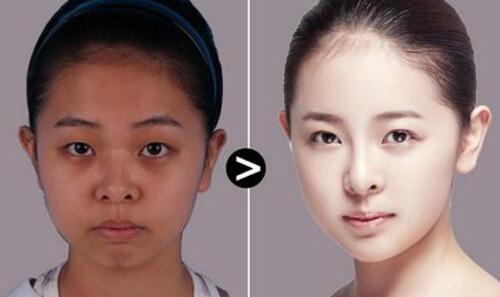 做光子嫩肤对皮肤伤害大吗