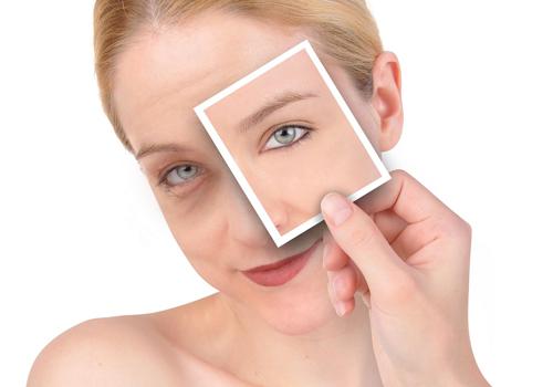 精油能去黑眼圈吗 选择正确精油告别熊猫眼