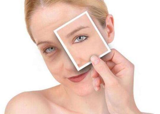 黑眼圈怎么消除 类型不同解决方法也大不同!