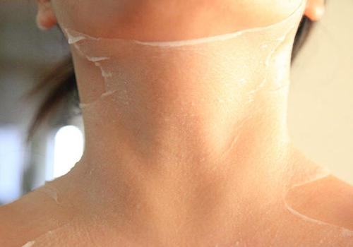 颈膜有用吗