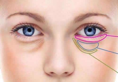 下眼袋可以去掉吗 只要发现的早，去除下眼袋就不是梦想！