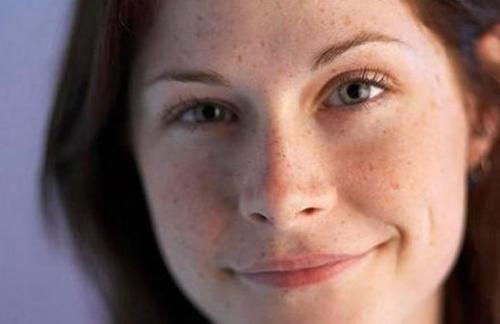 什么原因脸上长色斑 色斑形成主要原因