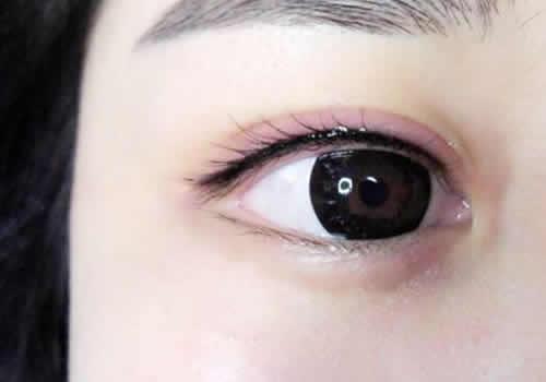纹美瞳线眼睛会肿几天