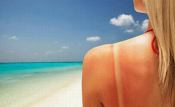 晒伤了用芦荟胶有用吗 晒伤敷芦荟胶、小黄瓜？使用不当可能适得其反！