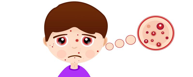 为什么鼻子一挤就有白色的东西 为什么鼻头的白色条状总是挤不尽