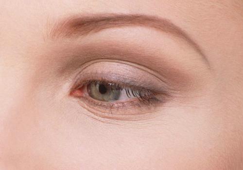 如何预防眼部皱纹 眼部皱纹是怎么形成的