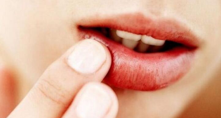 嘴唇干燥怎么办 找回唇净光采？三招解决嘴唇干燥问题
