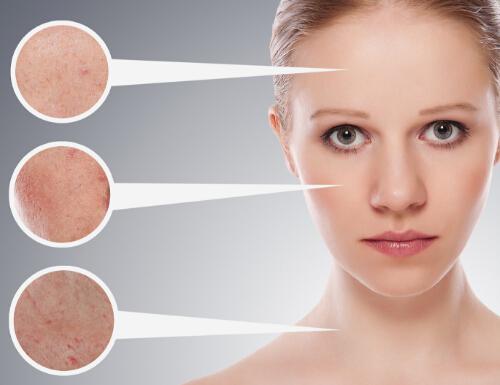 激光美白的危害 激光美白的副作用