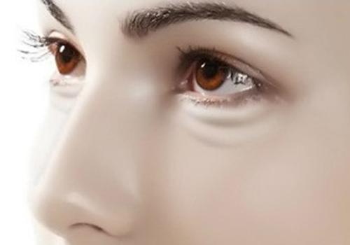 黑眼圈怎么样消除 祛除黑眼圈吃什么好