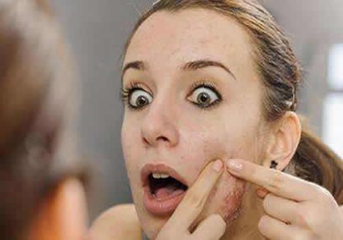 激光祛痘效果怎么样