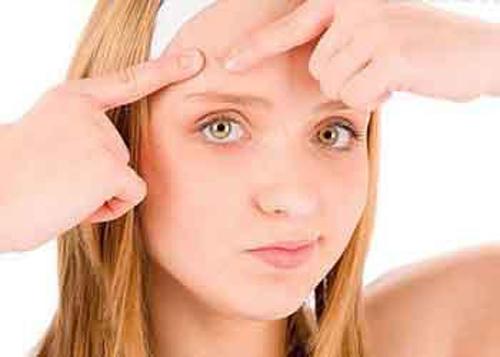 冬天怎么防止长痘痘 冬季如何正确护肤