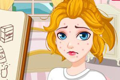 青春痘怎么去除 彻底解决痘痘烦恼