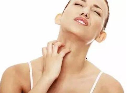 皮肤过敏怎么办 治疗过敏小妙招