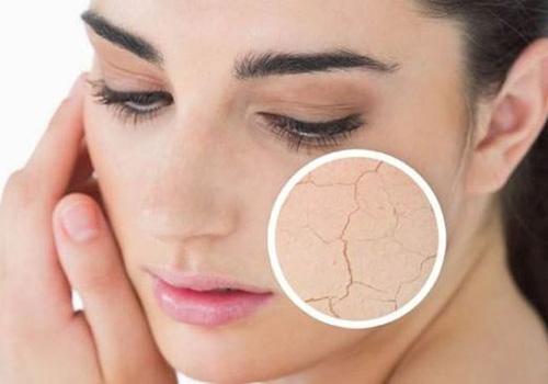 夏季皮肤脱水的症状有哪些 5大表现需警惕