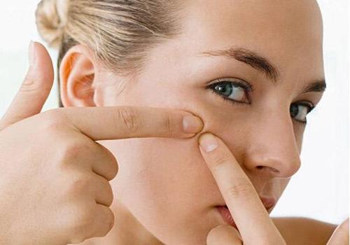 脸上长痘痘是什么原因 现在就让你知真相