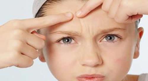 闭口粉刺可以挑吗