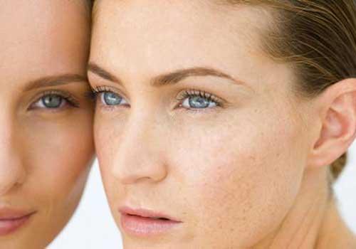 维生素E能去祛斑吗 用对了想不美都不行