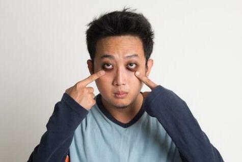 怎么消除黑眼圈 黑眼圈有几种