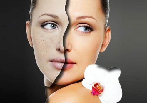 e光祛斑的利与弊