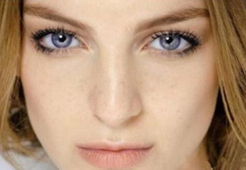 长斑是什么原因引起的 为什么脸上会突然长斑呢