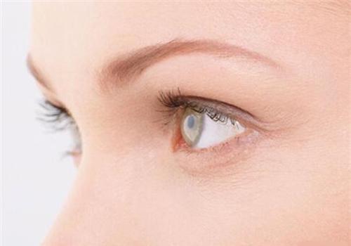 鱼尾纹是怎么形成的 如何预防鱼尾纹