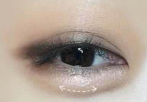 卧蚕是怎么形成的