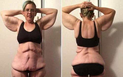 减肥后皮肤松弛怎么办 7招让你恢复紧致弹性