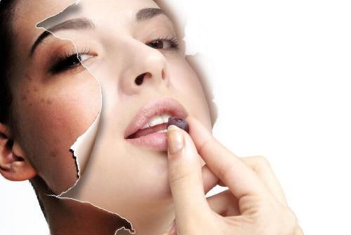 怎样快速祛斑 5个方法简单易学