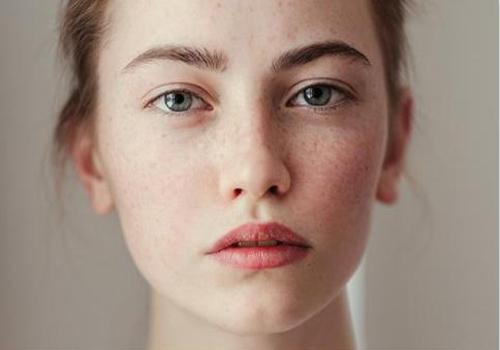 夏季如何防晒斑 这7点一定要做到