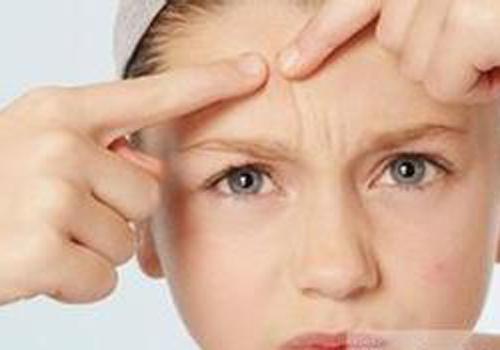 拔火罐能去痘痘吗