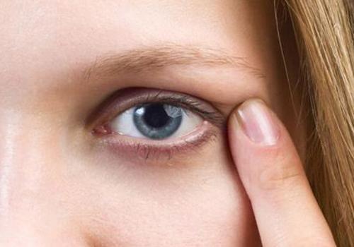 黑眼圈太重怎么办 三个小方法帮你找回魅力电眼