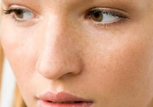 来月经能做激光祛斑吗 什么时候做才好