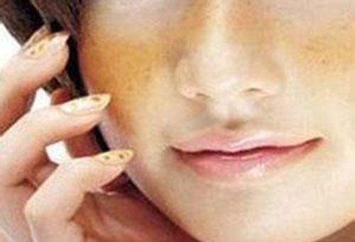 脸色发黄为什么 脸色发黄不是小事