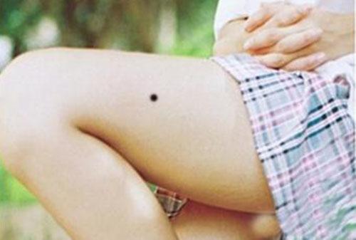 长痣的原因 日常生活中怎样减淡色素痣