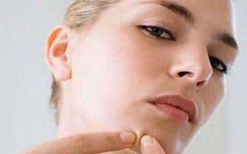 女的下巴长痘什么原因 女人下巴长痘的原因