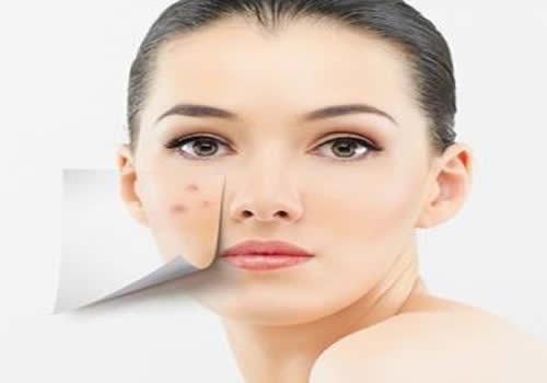 不洗脸会长痘痘吗 脸都不洗，还想不长痘痘？