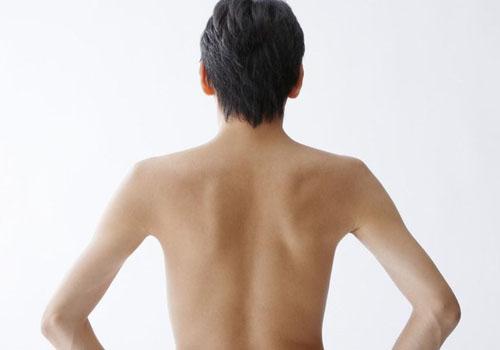 背上的痘疤怎么去