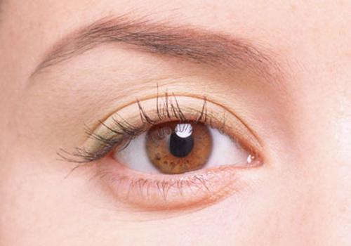 开眼角后疤痕增生