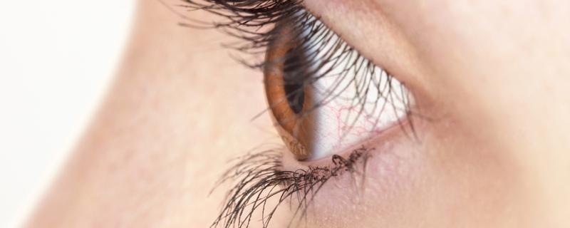 眼角纹多是什么原因 怎么改善眼角纹