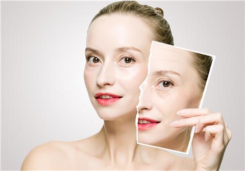 雀斑是如何形成的 脸上长雀斑怎么去掉