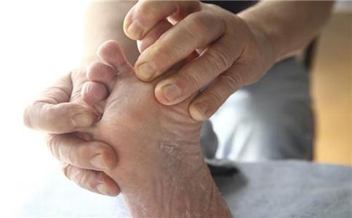 有什么偏方治脚气 有什么偏方治脚气吗