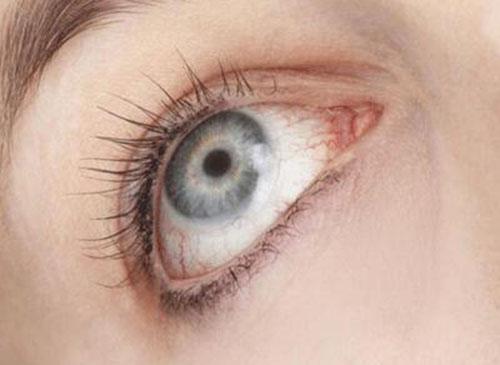白内障的症状 白内障的症状及治疗