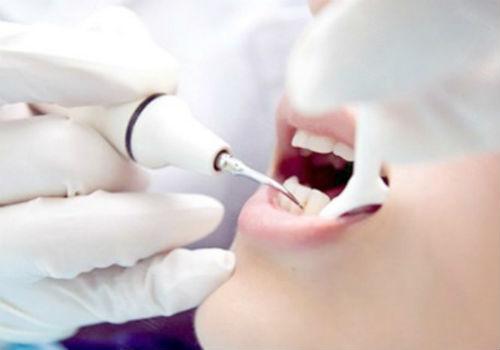 嘴巴里面咬破了成了溃疡怎么办 嘴里咬破了变成了溃疡怎么治